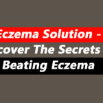 Eczema Solution - Discover The Secrets Of Beating Eczema